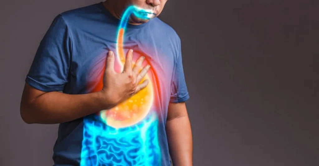 5 loại đồ uống tốt nhất giúp giảm chứng ợ nóng hiệu quả 1 trao nguoc da day
