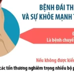 dai thao duong avatar