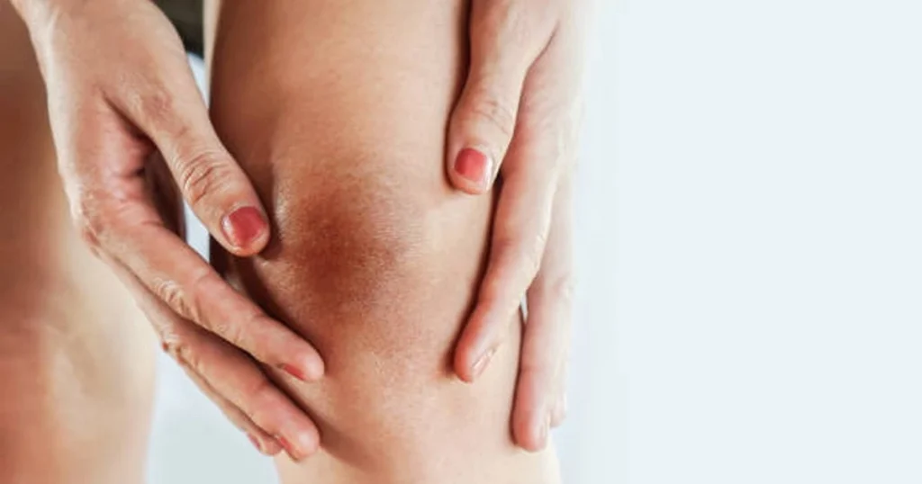 Bí quyết làm sáng các vùng da khó nhằn không phải ai cũng biết 1 da dau goi
