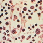 benh pham virus hanta 1